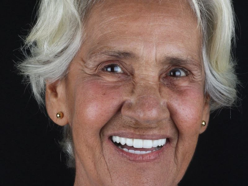 Implante Dentário